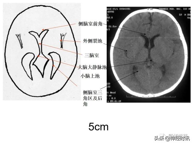 人体解剖学图解头部（解剖影像）(15)