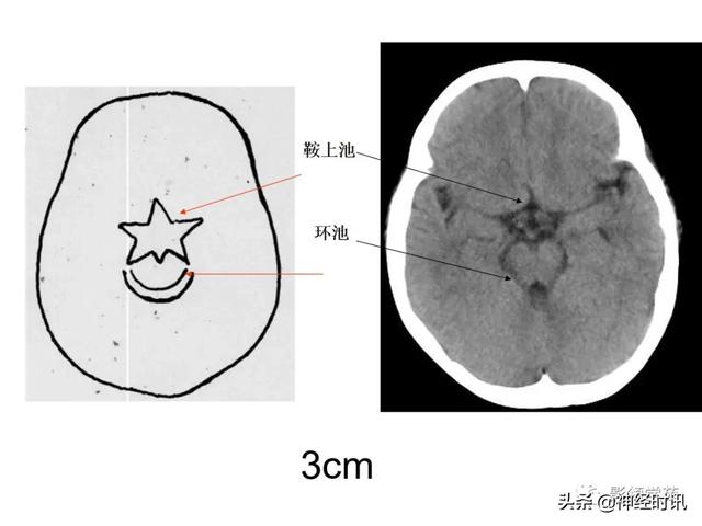 人体解剖学图解头部（解剖影像）(9)