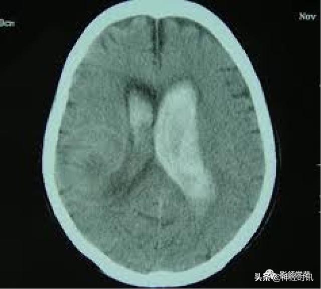 人体解剖学图解头部（解剖影像）(47)