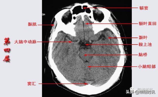 人体解剖学图解头部（解剖影像）(8)