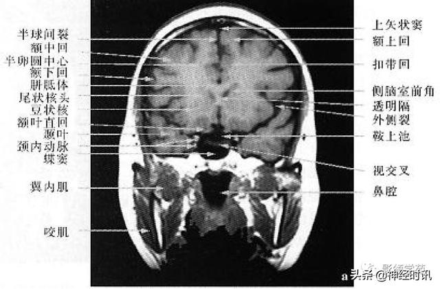 人体解剖学图解头部（解剖影像）(28)