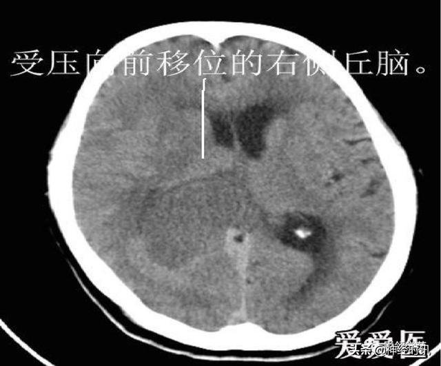 人体解剖学图解头部（解剖影像）(54)