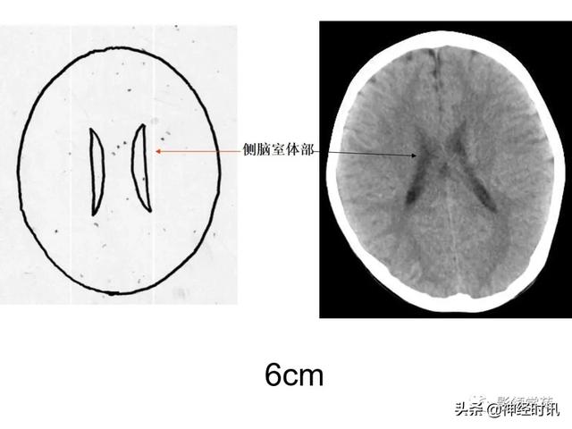 人体解剖学图解头部（解剖影像）(24)