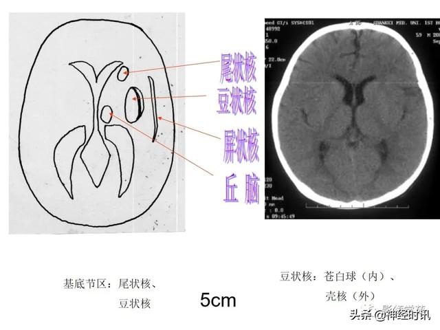 人体解剖学图解头部（解剖影像）(18)