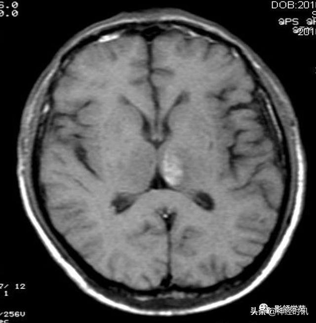 人体解剖学图解头部（解剖影像）(53)