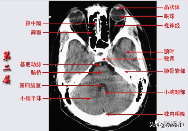 人体解剖学图解头部（解剖影像）(5)