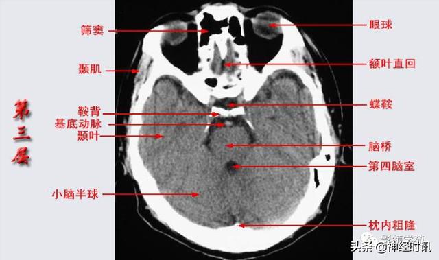 人体解剖学图解头部（解剖影像）(6)