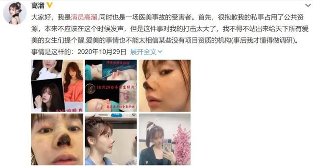 整形失败去世的女明星（12位被整形毁掉的女星）(13)