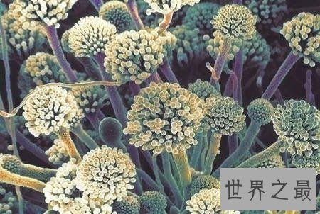 世界上最危险的10种细菌，第二种就在人体内！