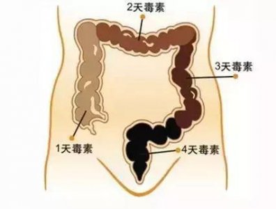 ​肠道里竟然有10斤垃圾!还好有ta!