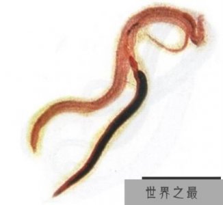 ​吸血虫的恐怖,防范的同时需认清它的真面目