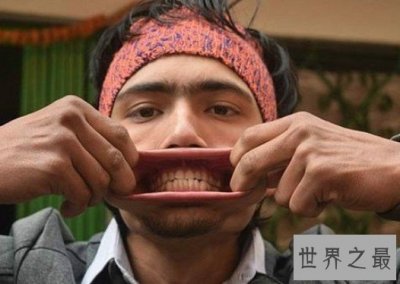 ​世界第一大嘴，嘴巴里塞入了138根铅笔