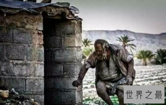 人类最长时间不洗澡记录,想想都觉得难受。