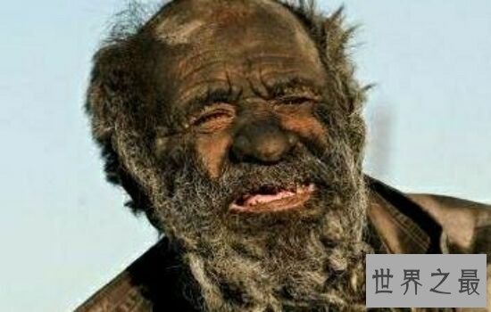 人类最长时间不洗澡记录,想想都觉得难受。