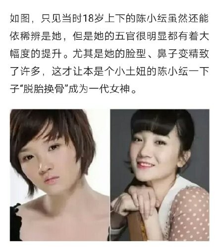 陈小纭公开承认曾“整容”十几次，旧照曝光后，网友：差距太大了