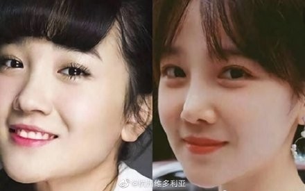 陈小纭公开承认曾“整容”十几次，旧照曝光后，网友：差距太大了